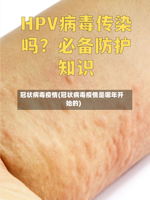 冠状病毒疫情(冠状病毒疫情是哪年开始的)